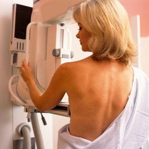 Margulies mammogram image